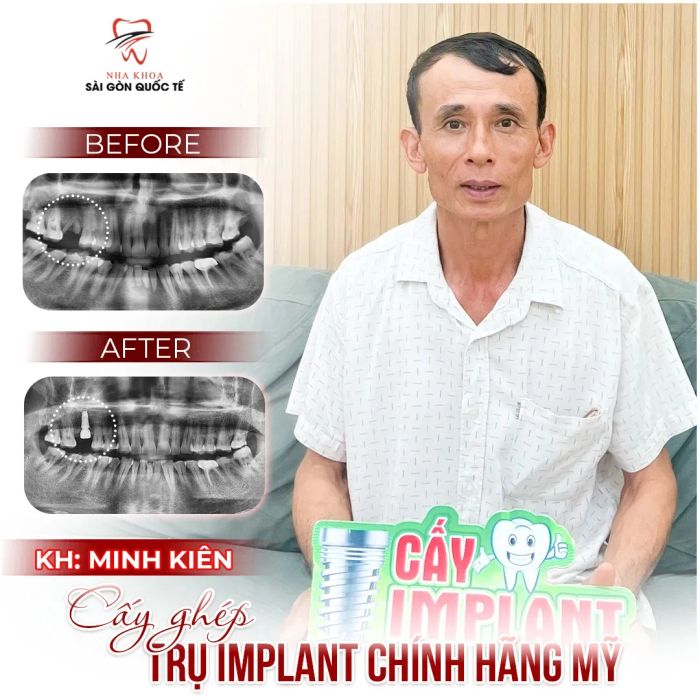 Hình ảnh Nha Khoa Sài Gòn Quốc Tế - Đơn vị tiên phong về thẩm mỹ nha khoa tại Buôn Ma Thuột
