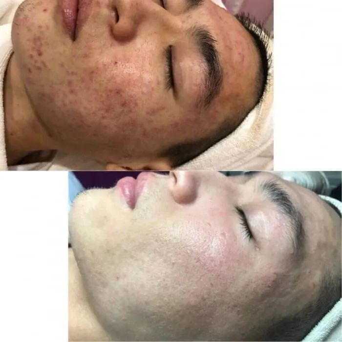 Nàng Spa hình ảnh 1