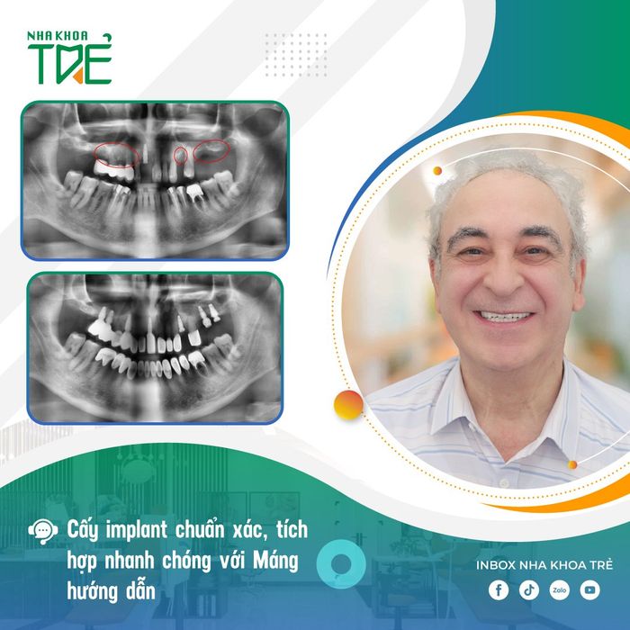 Hình ảnh Nha Khoa Trẻ 2