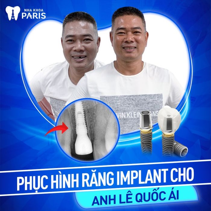 Hình ảnh Nha Khoa Paris 2
