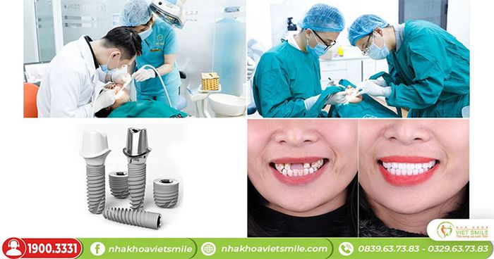 Hình ảnh Nha Khoa Việt Smile 2