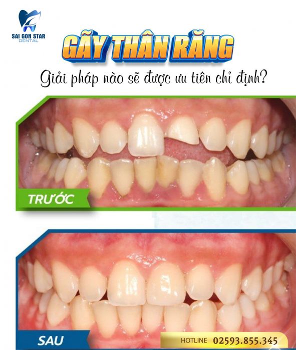 Hệ thống máy móc hiện đại tại Nha Khoa Sài Gòn Star (Ảnh 2)