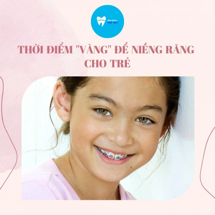 Quy trình niềng răng chuyên nghiệp tại Nha khoa Phú Quý (Ảnh 2)