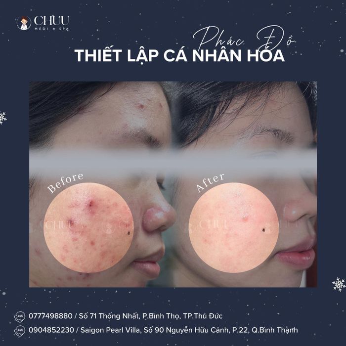 Hình ảnh không gian sang trọng tại Chuu Medi Spa - Saigon Pearl