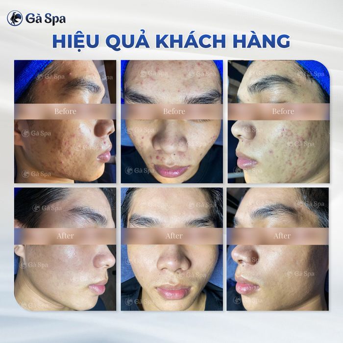 Bộ sưu tập hình ảnh Gà Spa Thủ Đức - Nơi gửi gắm làn da với đội ngũ chuyên gia giàu kinh nghiệm