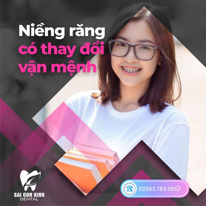 Quy trình niềng răng chuẩn y khoa tại Nha Khoa Sài Gòn Xinh (Ảnh 2)