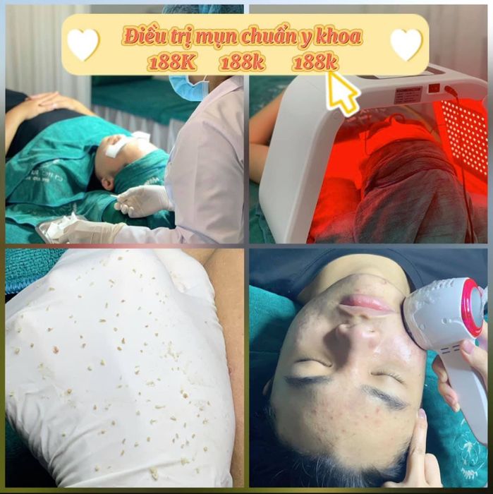 Hình ảnh quy trình điều trị chuyên nghiệp tại Chic Spa Thủ Đức