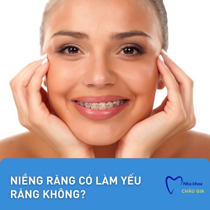 Quy trình niềng răng chuẩn quốc tế tại Nha Khoa Châu Gia (Ảnh 2)