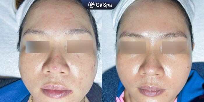 Hình ảnh thực tế Gà Spa Thủ Đức - Không gian sang trọng với công nghệ trị liệu da hiện đại