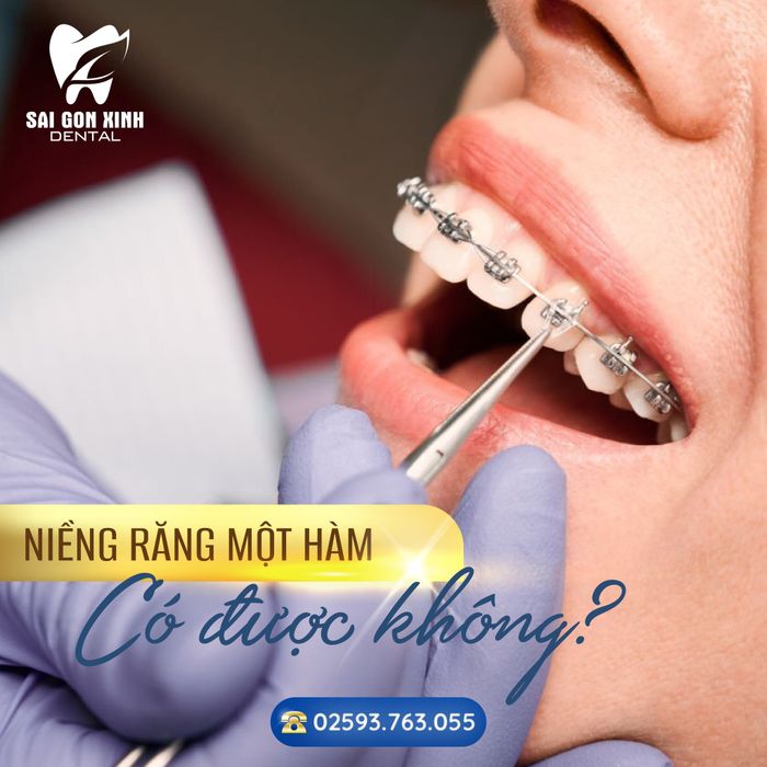 Hệ thống máy móc hiện đại tại Nha Khoa Sài Gòn Xinh (Ảnh 3)