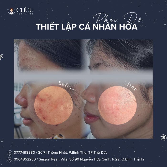 Hình ảnh không gian trị liệu đẳng cấp tại Chuu Medi Spa - Saigon Pearl