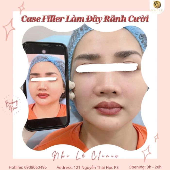 Hệ thống máy móc hiện đại và phòng tiêm chuẩn y khoa tại NHI LÊ Clinic