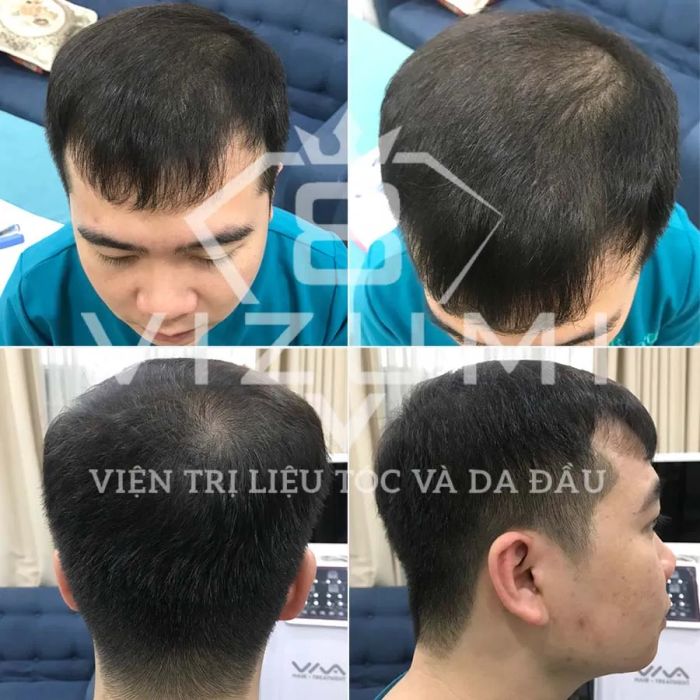 Hình ảnh Dr.Lozen Vietnam - Công nghệ trị liệu hiện đại