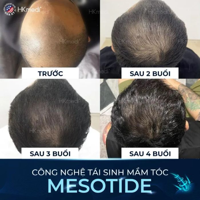 Hình ảnh Phòng Khám Chuyên Khoa Da Liễu Hoa Kỳ - Không gian điều trị tiêu chuẩn