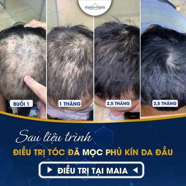 Phòng Khám Da Liễu Chuyên Sâu MAIA & MAIA - Nơi chăm sóc sắc đẹp toàn diện với hình ảnh minh họa sống động