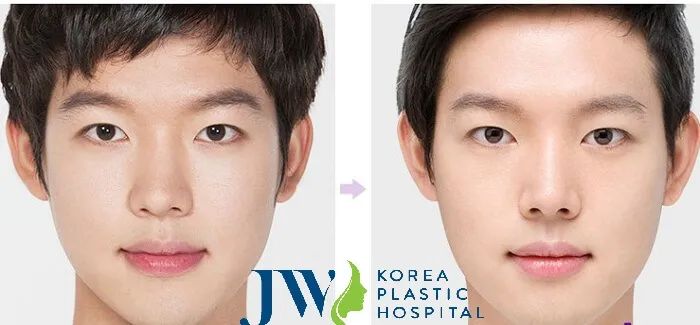 Hình ảnh thực tế Bệnh viện thẩm mỹ JW Hàn Quốc