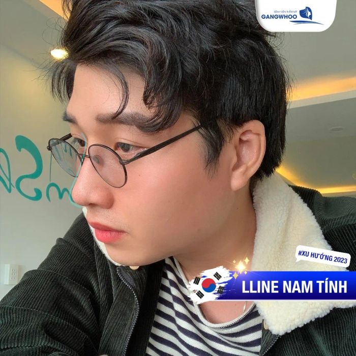 Hình ảnh thực tế quy trình nâng mũi tại Gangwhoo