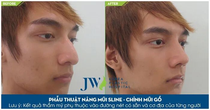 Hình ảnh Bệnh viện thẩm mỹ JW Hàn Quốc