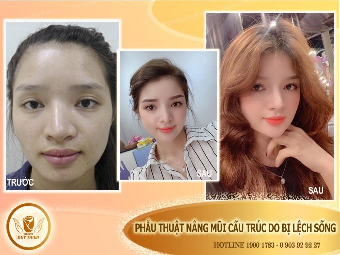 Hệ thống phòng mổ vô trùng tiêu chuẩn tại Duy Thiện