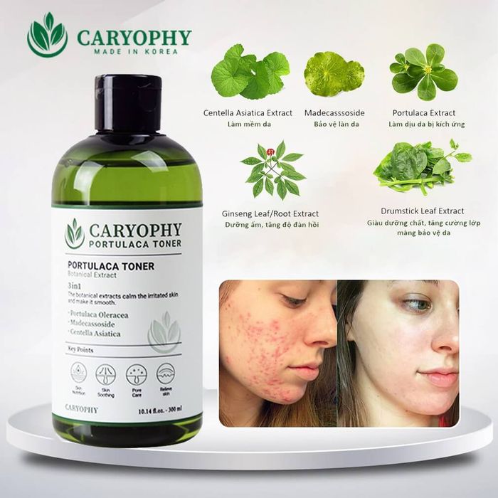 Caryophy Portulaca Toner - Hình ảnh thực tế sản phẩm