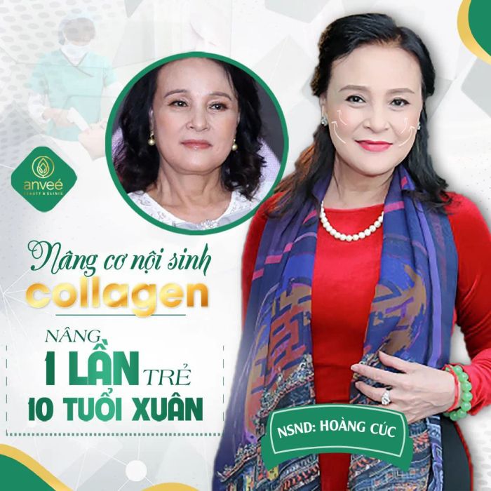 Hệ thống máy móc hiện đại chuẩn Hàn Quốc tại ANVEÉ