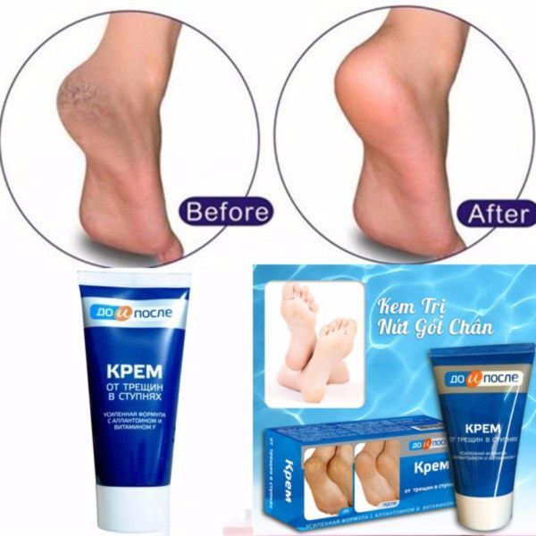 Hình ảnh minh họa Kem Kpem Apteka (ảnh 2)