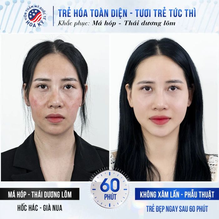 Hệ thống máy móc hiện đại tại Viện Thẩm Mỹ Quốc Tế Hoa Kỳ