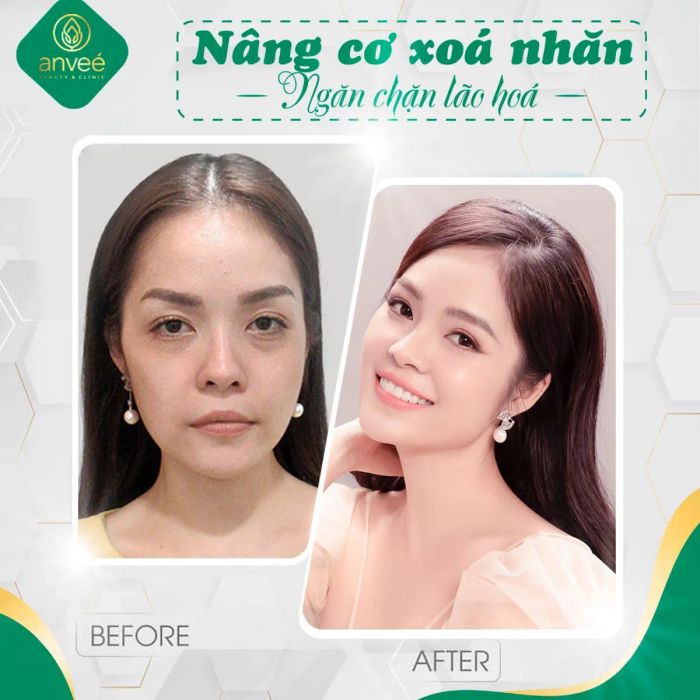 Không gian sang trọng đẳng cấp tại Viện thẩm mỹ ANVEÉ