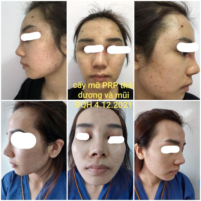 Hệ thống phòng mổ vô trùng tiêu chuẩn quốc tế tại phòng khám