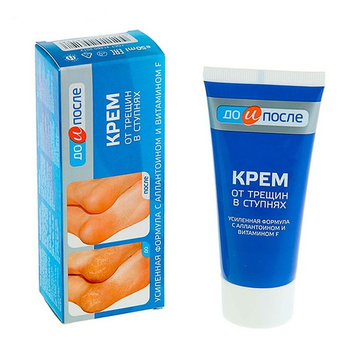 Hình ảnh thực tế Kem Kpem Apteka chính hãng Nga (ảnh 1)