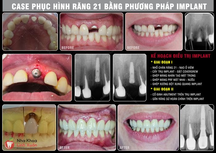 Không gian hiện đại tại Nha Khoa LINH XUÂN