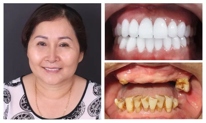 Hệ thống trang thiết bị hiện đại tại Nha khoa Kim