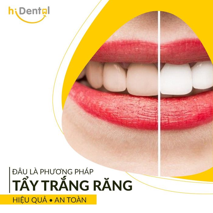 Hệ thống trang thiết bị tân tiến tại Nha khoa hiDental