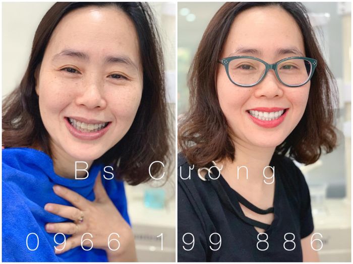 Hệ thống trang thiết bị hiện đại tại Nha Khoa Quốc Tế Shine