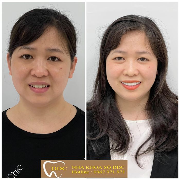 Hình ảnh thực tế Nha khoa số DDC