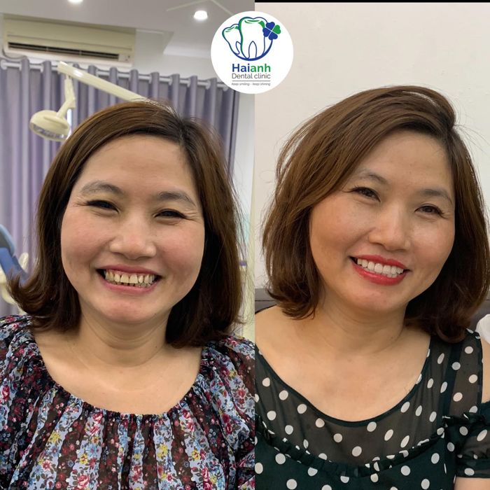 Hệ thống máy móc hiện đại tại Nha Khoa Hải Anh