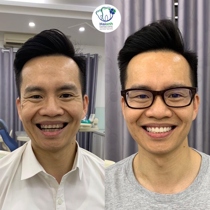 Không gian sang trọng tại Nha Khoa Hải Anh