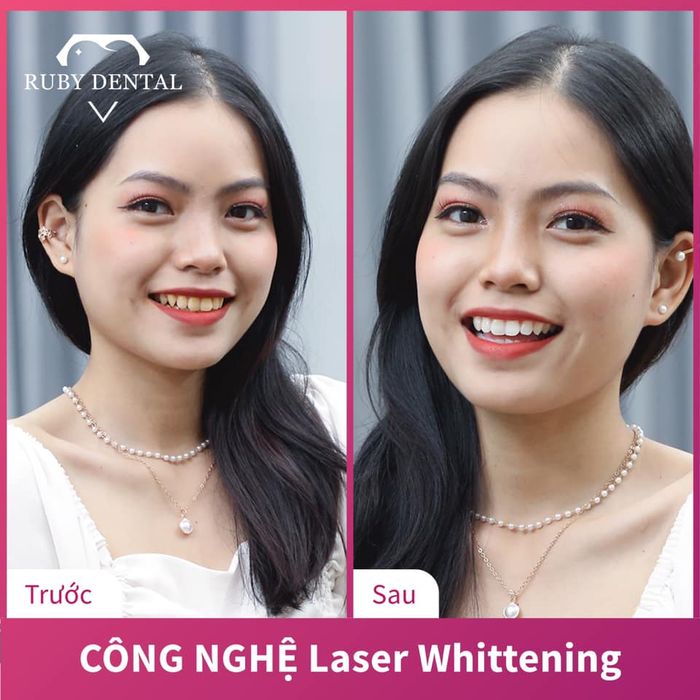 Hệ thống máy móc hiện đại tại Ruby Dental