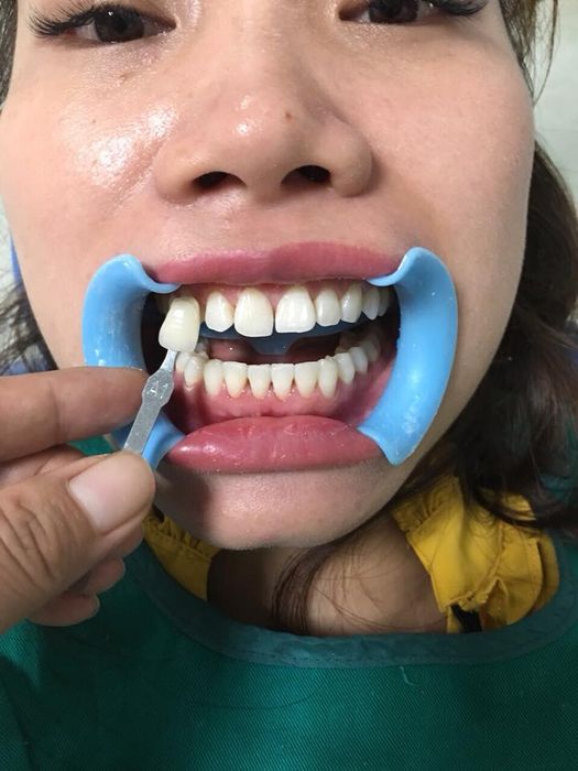 Hệ thống máy móc tân tiến tại Trung tâm Nha khoa & Thẩm mỹ Anh Dũng