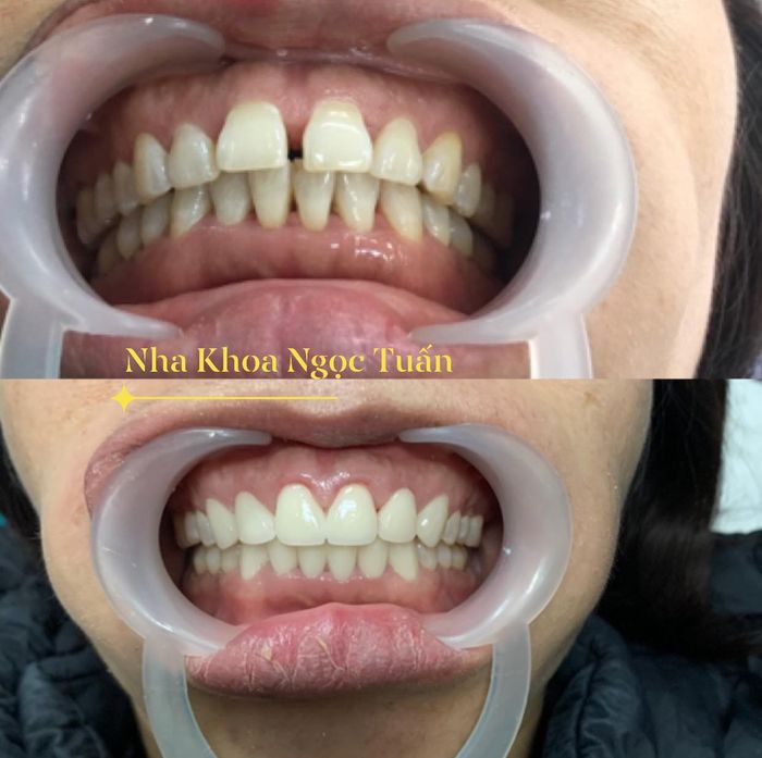 Không gian hiện đại tại Nha Khoa Ngọc Tuấn