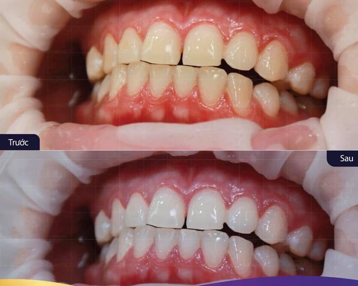 Không gian hiện đại tại Nha Khoa Duy Hưng