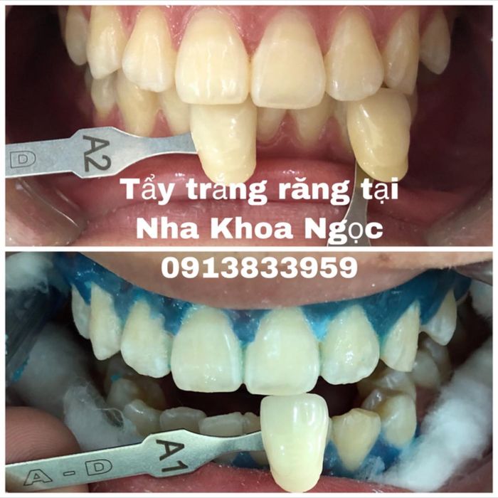Hình ảnh phòng khám Nha Khoa Ngọc