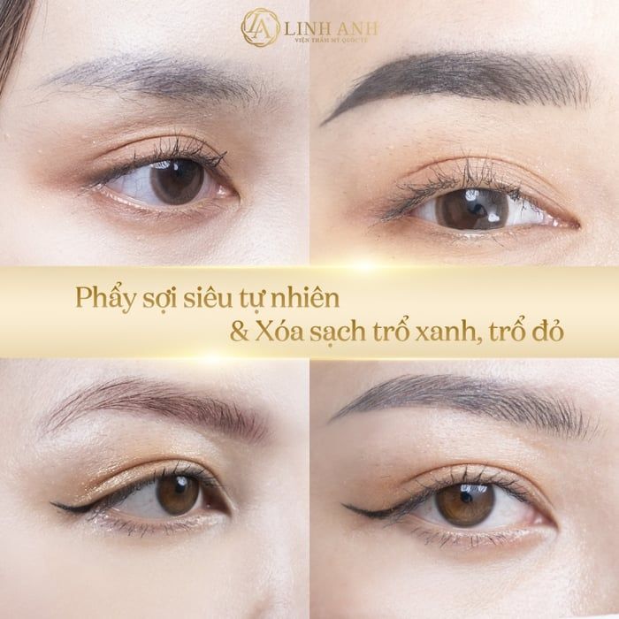 Thẩm Mỹ Viện Quốc Tế Linh Anh - Hình ảnh 1