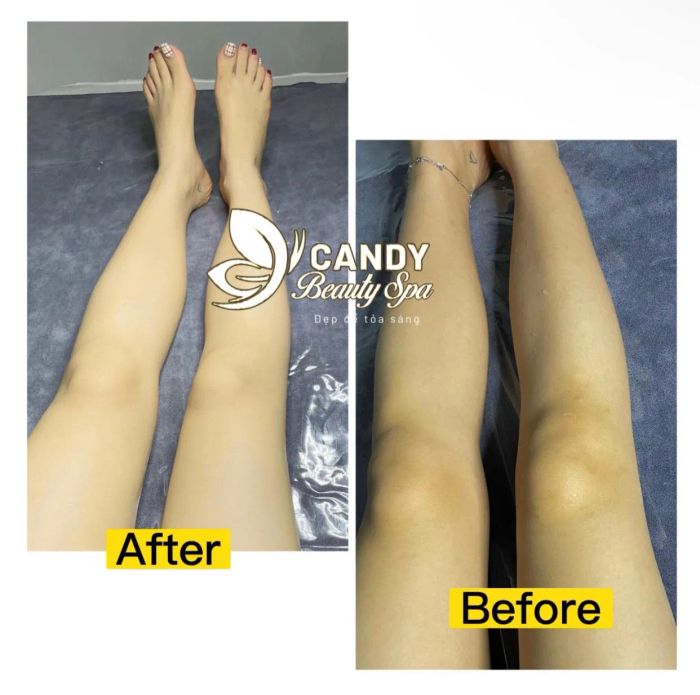 Hình ảnh quy trình tắm trắng cao cấp tại CANDY Beauty Spa