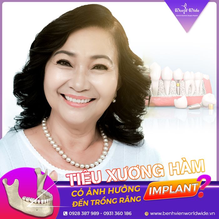 Hình ảnh cơ sở vật chất hiện đại tại Bệnh viện Răng Hàm Mặt Worldwide