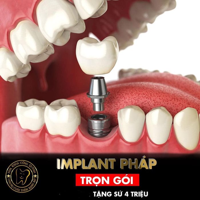Hình ảnh phòng khám hiện đại tại Nha Khoa Cống Quỳnh
