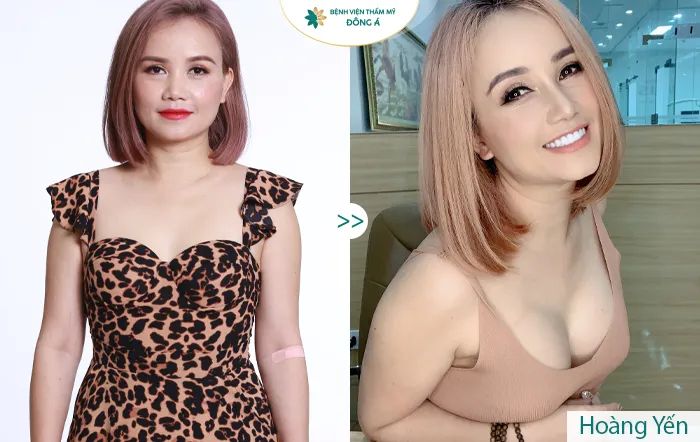 Hình ảnh Bệnh Viện Thẩm Mỹ Đông Á