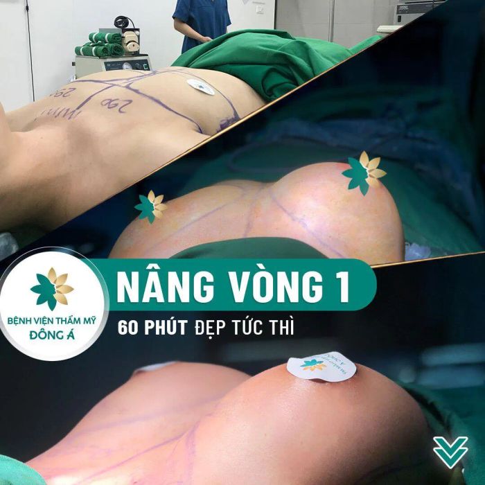 Hình ảnh ấn tượng về Bệnh Viện Thẩm Mỹ Đông Á