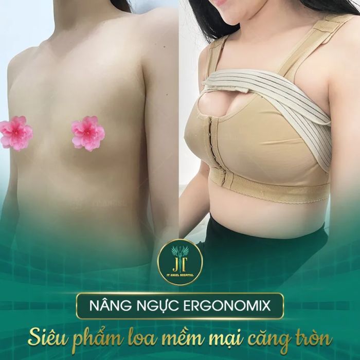 Hình ảnh ấn tượng về Bệnh Viện Thẩm Mỹ JT Angel