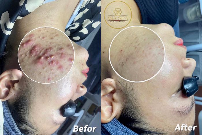 MiA SPA ảnh 1